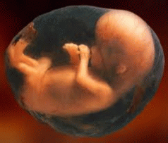 Toxic pesticides from GM food crops found in unborn babies 3