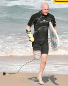 Shark bite victims unite to save sharks 3