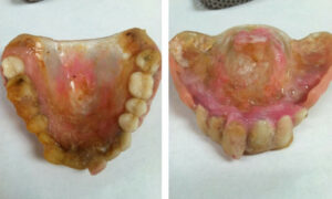 ADA - Why Does Oral Health Matter So Little? 21