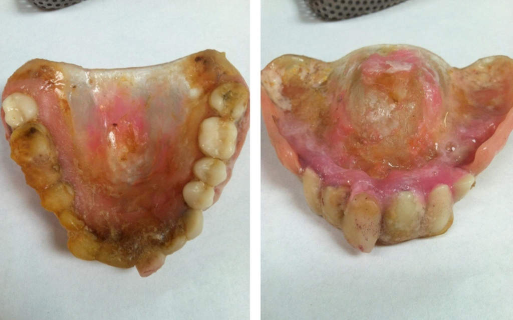 ADA - Why Does Oral Health Matter So Little? 1