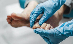 District Nurses Announces New, Improved Podiatry Service for Clients 9