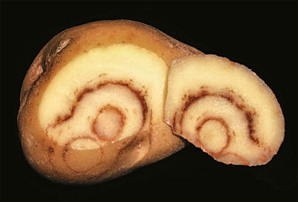 Potato Virus Puts Pressure on Tasmanian Farmers 5
